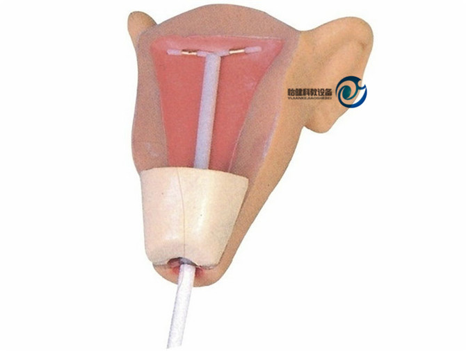 高级宫内避孕器训练模型